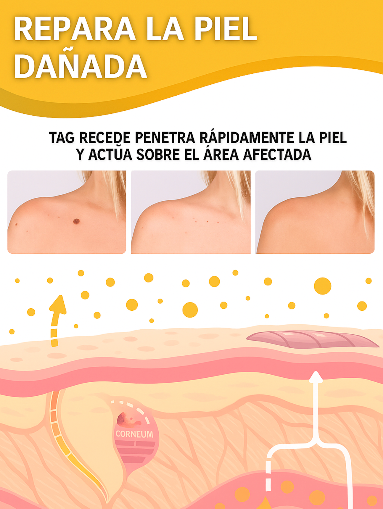 Tag Recede™: Spray Eliminador de Verrugas Instantáneo